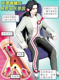 经济舱综合征