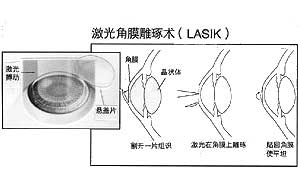 β