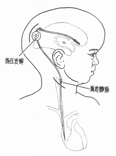 63101.jpg (28004 �ֽ�)