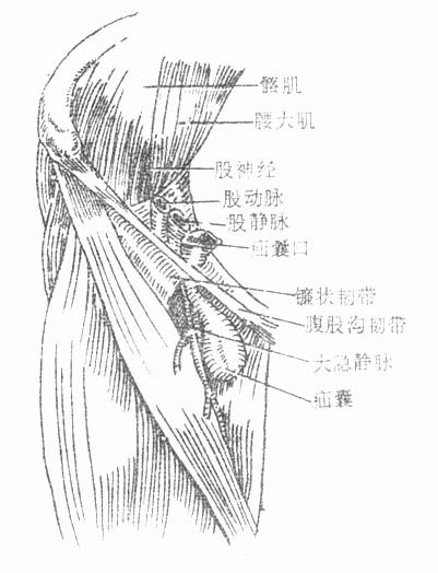 骨盆较宽阔,联合肌腱及陷窝韧带常发育不全或变薄,导致股环宽大松弛